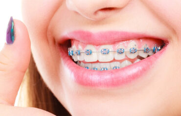 Orthodontics