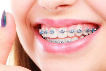 Orthodontics