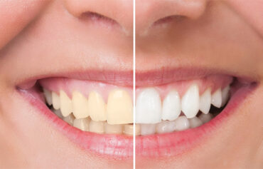 Cosmetic Dentistry & Smile Design