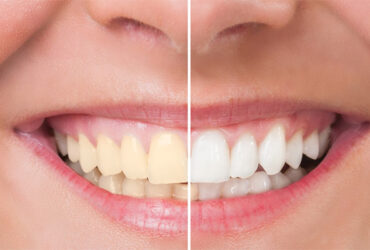 Cosmetic Dentistry & Smile Design